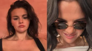 Selena Gomez Addresses ‘Mustache’ Comment with Grace, Speaks Candidly About Her Skin Condition